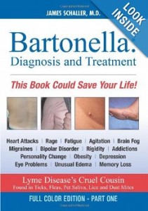 Bartonella  Diagnosis and Treatment