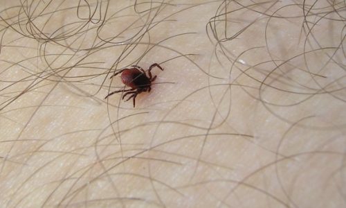 Maladie de Lyme, quand les tiques attaquent…