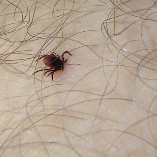 Maladie de Lyme : un véritable problème diagnostique