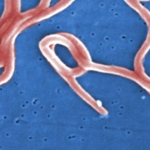 Maladie de LYME: A la recherche des gènes bactériens responsables de la virulence